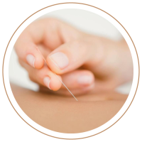 Servicios-Acupuntura3