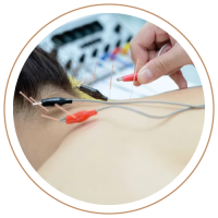 Servicios-Cat-1electroacupuntura
