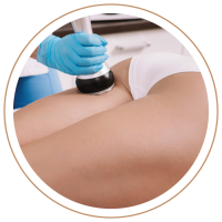 Servicios-Cat-2-celulitis